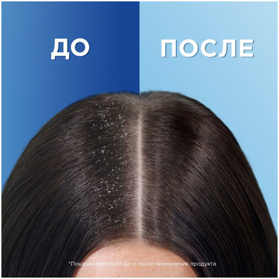 HEAD & SHOULDERS Бальзам-ополаскиватель против перхоти Яблочная свежесть 275мл